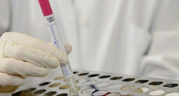 قطر تعلن تسجيل إصابة جديدة بفيروس كورونا