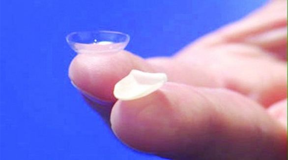 العدسات اللاصقة..أحدث صرعة لتجميل الأسنان