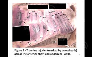 فريق مختص ينشر صورا مروعة: تعذيب وتجويع وقتل ممنهج في سوريا