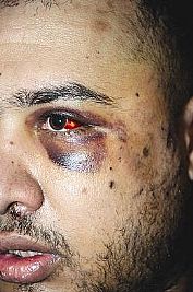 حادثة حسين الشواف تتصاعد،البراك يتهم الداخلية