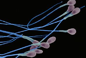 اكتشاف جين مرتبط بالعقم عند الرجال