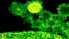 الامارات تعلن تعافي خمس حالات مصابة بفيروس ‘كورونا’