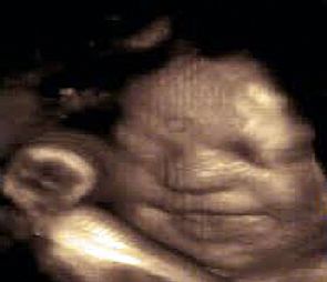 صورة : جنين يبتسم في بطن أمه قبل ولادته بأسابيع