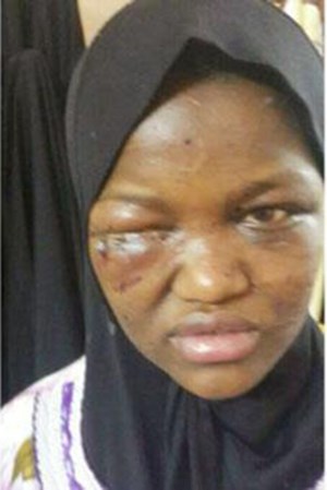 بالصور.. بلاغ من الجيران ينقذ خادمة إثيوبية من تعذيب كفيلها بمكة