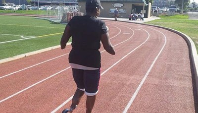 قصة مرعبة عن جراحات التجميل الرخيصة.. قطع أطراف ومشارفة الموت