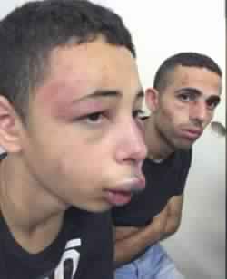 بالفيديو… لحظات مروعة لضرب الطفل الفلسطيني بطريقة وحشية من قبل جيش الاحتلال الإسرائيلي