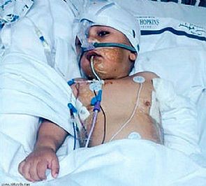 اعتداءات الخدم في الخليج تتواصل،خادمة تدخل ‘رضيعاً’ العناية المركزة في الإمارات