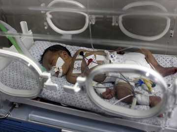 وفاة طفلة غزة التي خرجت حيّة من رحم أمها المتوفاة