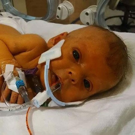 بالصور.. متطوعون “يفزعون” لأب طلب تعديلاً على صورة طفلته الراحلة