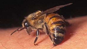 رجل ينجو من الموت بعد تعرضه لألف لدغة نحل