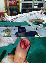 اعتداء ‘دموي’ من مواطن على طبيب وممرض في العدان