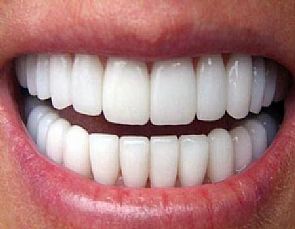 علماء : الأسماك أصل أسنان البشر