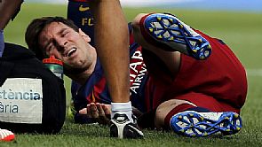 دوري الأبطال.. برشلونة يواجه ليفركوزن دون ميسي