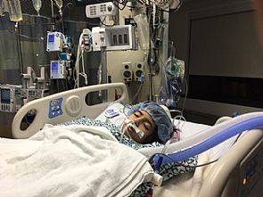 اللميع: نجاح عملية زراعة الكبد لـ اولى أبناء اسرة بتول