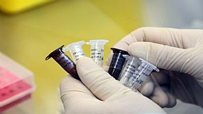 إيران: ارتفاع عدد الوفيات بإنفلونزا الخنازير إلى 42