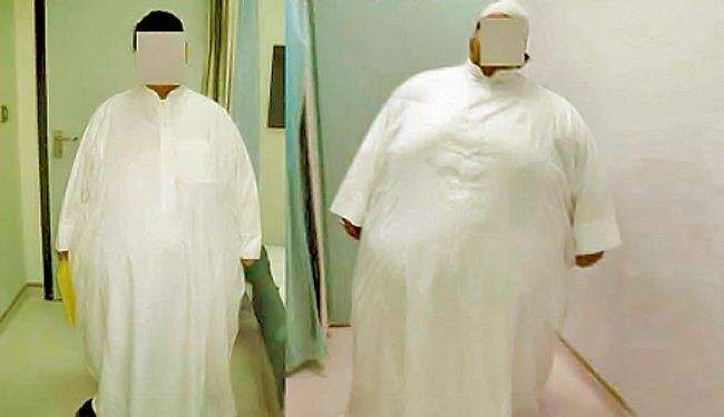 «رابطة السمنة» تحارب البدانة: الكويت الأولى عربيا والثانية عالميا