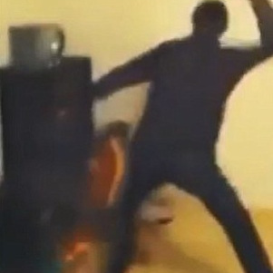 أب كسر جمجمة ابنته