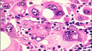 571a34cfc361888f5d8b4582