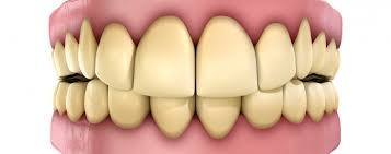 احذر أطعمة ومشروبات تسبب أصفرار الأسنان