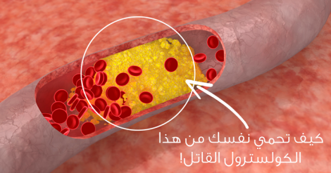 كيفية تقليل نسبة الكوليسترول في الدم ؟ نصائح منزلية سهلة..