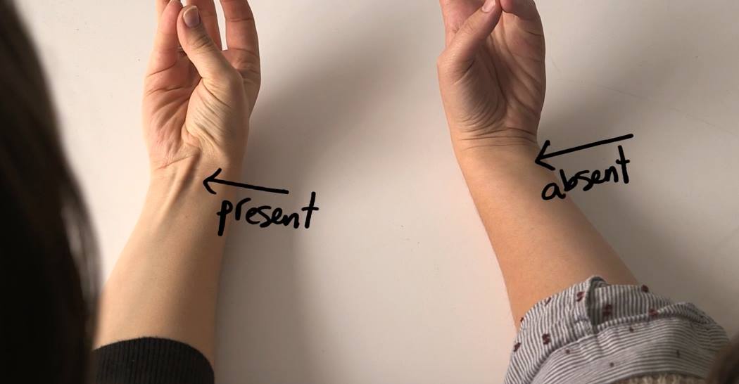 ما هو سبب بروز العروق من معصمك ؟