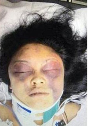 صورت سيلفي فضربها بمطرقة اللحم!