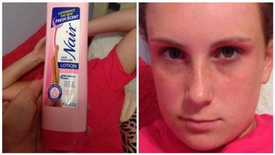 بالصور …استخدمت مزيل الشعر بدل الشامبو وهذا ما حدث لها!