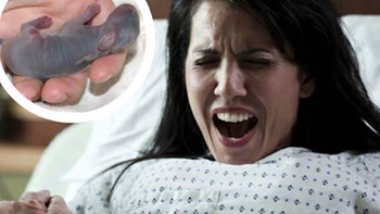 حقيقة المرأة التي انجبت جنين على شكل ارنب .. كيف حصل ذلك!