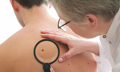 أصحاب هذه المهن معرضون لسرطان الجلد