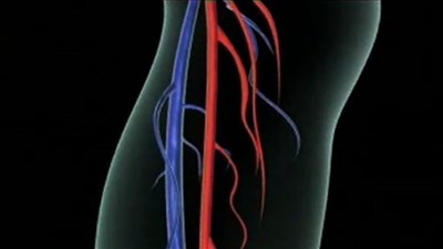 5 أطعمة لعلاج مشاكل تدفق الدمّ واحتباس المياه في الجسم