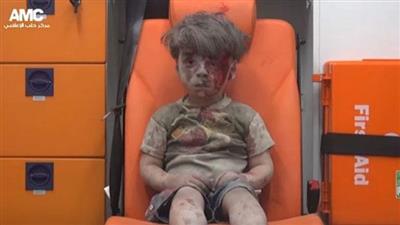 سوريا.. وفاة شقيق الطفل «عمران» جراء القصف