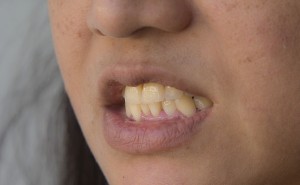 670px-Whiten-Your-Teeth-with-Banana-Peel-Step-3Bullet2