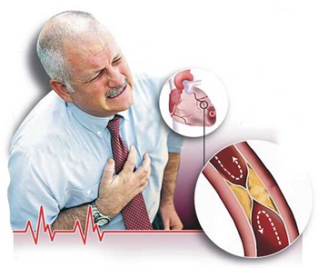 بالفيديو.. تعرف على مشروب طبيعى لتنظيف الشرايين وتخفيض مستويات الكوليسترول
