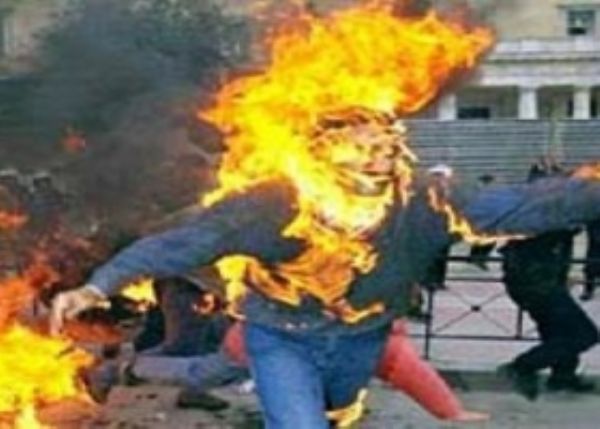 اراد احراق زوجته فخرجت سالمة واصيب هو بحروق خطرة