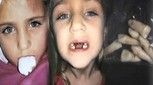 منعها طبيب الأسنان من الدخول بينما يفحص ابنتها… لن تصدقوا ماذا فعل!