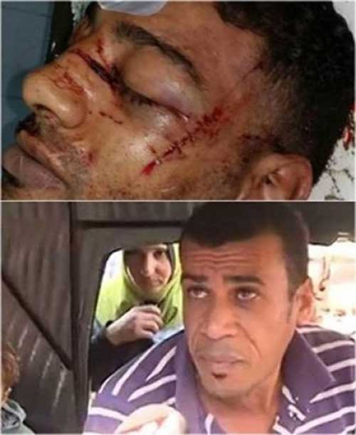 بالفيديو.. بعد اختفائه والحديث عن اعتقاله و مقتله،”خريج التوكتوك ” يكشف التفاصيل!؟