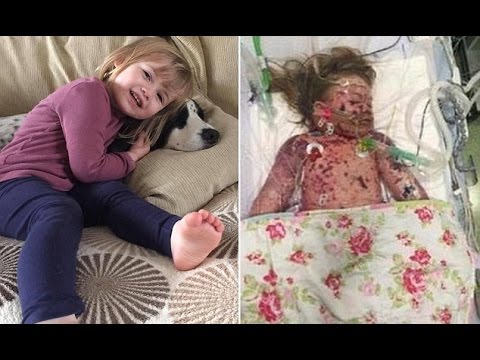 نشرا صورة ابنهما قبل وفاته بلحظات لتنبيه كل الأهل إلى خطورة هذا المرض