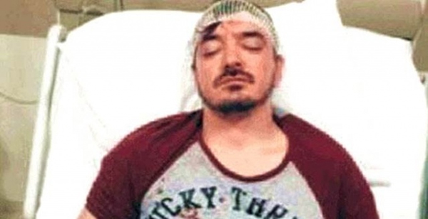 نجم تركي ينجو بصعوبة من محاولة جيرانه قتله