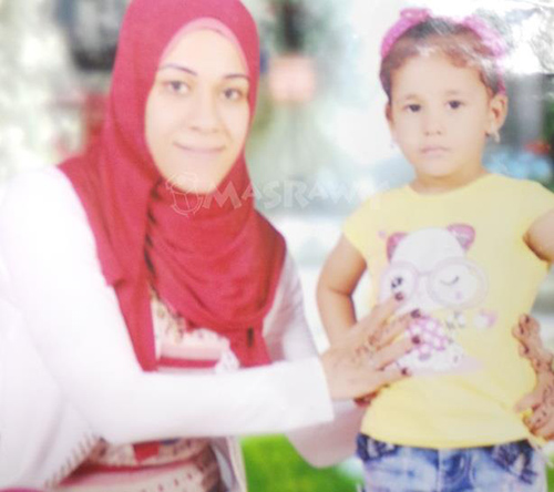 بالصور…دافعت عن شرفها فحرقها شقيق زوجها بـ”الزيت المغلي”