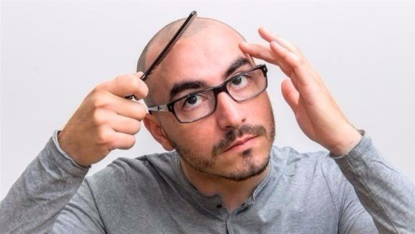 لهذه الأسباب لا تخجل من حلق كامل شعر رأسك