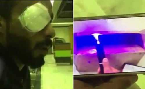 بالفيديو.. شاهد كيف فقد شاب سعودي إحدى عينيه بسبب المزاح مع صديقه بالليزر الحارق !