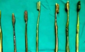 فتاة تبتلع 7 فراشي أسنان بعد محاولة إجبارها على الزواج