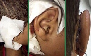 معلم يعاقب طفلا بخلع أذنه!