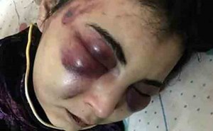 ماذا فعلت هذه المصرية حتى عذبها زوجها بوحشية؟