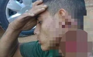 حمل رأسه شبه المقطوع مئات الأمتار.. شاهد كيف حافظ شابٌ على حياته بعد شجار مع عصابة بالبرازيل