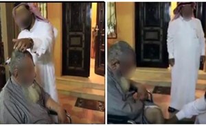 تفاصيل القبض على مدعي العلاج بالكي في حائل
