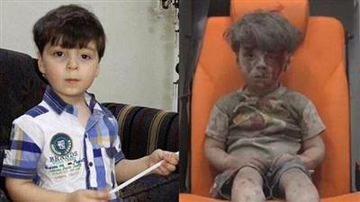 صور جديدة للطفل السوري عمران