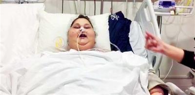 تقرير: «إيمان» أسمن امرأة في العالم أصبحت قادرة على تشغيل التليفزيون وتناول الأدوية