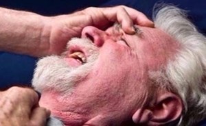 هذه العلامات تنذر بالسكتة الدماغية