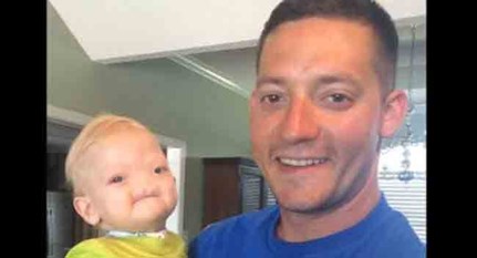 رحيل الطفل المعجزة.. عاش بدون أنف